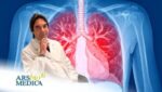 Lung Cancer Prevention